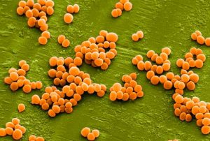 Metode și remedii populare pentru Staphylococcus aureus