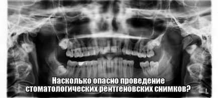 Cât de periculoasă este fotografia cu raze X dentare