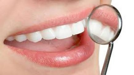 Відбілювання зубів - сучасна стоматологія в ЮЗАО ЮАО і зао