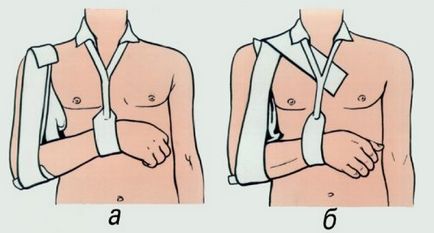 Bandage törött kulcscsontja