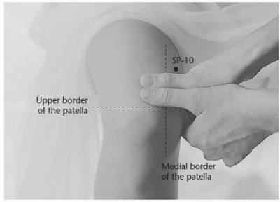 Element dispozitiv, acupunctura, acupunctura