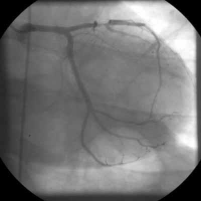 Propaedeutica în cardiologie