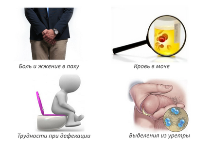 Prostatita la bărbați fotografii, cauze, imagini clinice și tratament