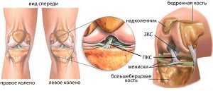 Розрив колінних зв'язок