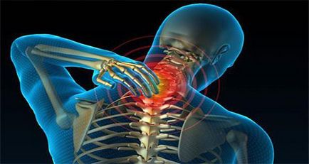 Osteochondroza cervicală și toate simptomele și tratamentul