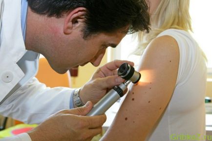 Mik a tünetek kezelhetők bőrgyógyász-onkológus