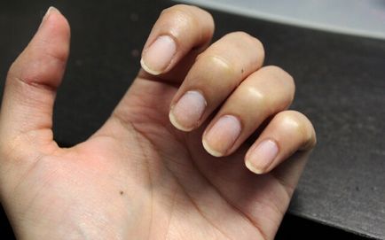 Scoateți shillak (shellac) acasă