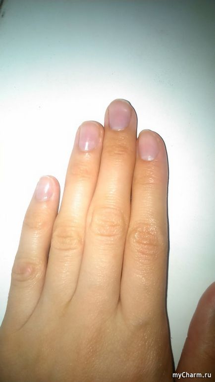 Sos-допомога для ослаблених нігтів - eveline cosmetics препарат sos мультивітамінний для зміцнення