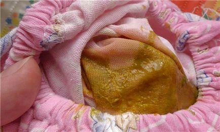 Стафілокок в кишечнику у грудничка золотистий кишкового стафілокок у грудних дітей, новонароджених