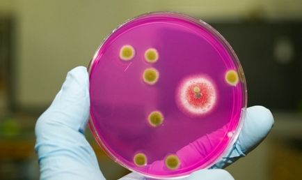 Stafilococul în intestinul sugarilor Staphylococcus aureus la sugari, sugari