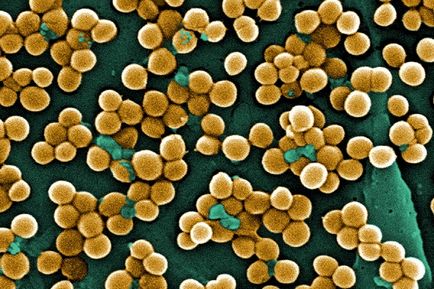 Stafilococul în intestinul sugarilor Staphylococcus aureus la sugari, sugari