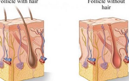 Трансплантація бороди, advanced hair clinics