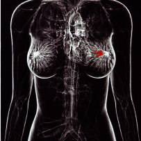 Ucimt - cluster - endosurgery în ginecologie și urologie
