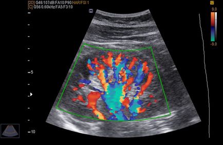 Uzis al cavității abdominale (uzi al abdomenului)