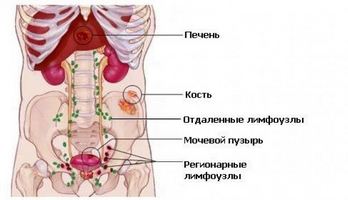 Ви дізнаєтеся як - вобензим - діє при простатиті