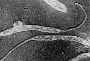 Bacteriile filamentoase predatory - stadopedia