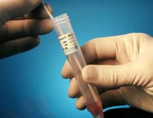 Krónikus candidiasis (szájpenész) oka a férfiak, kezelés () Krónikus candidiasis (szájpenész) oka a férfiak, a kezelés