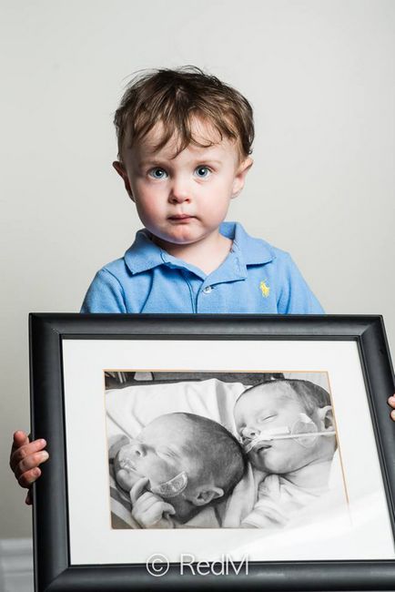 15 Puternici - înainte și după - fotografii ale copiilor prematuri