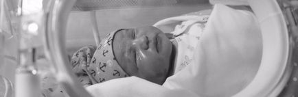 Sindromul fetal al alcoolului (asp) cauzează, simptome, diagnostic și tratament (sindrom) Sindromul fetal al alcoolului (asp) cauzează, simptome, diagnostic și tratament