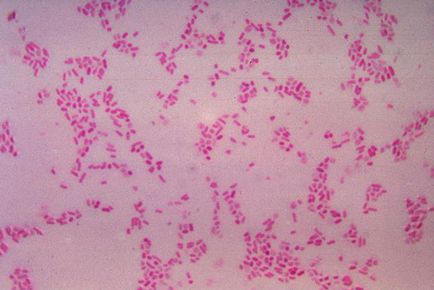 Bacteroides fragilis (bacteroides fragilis)