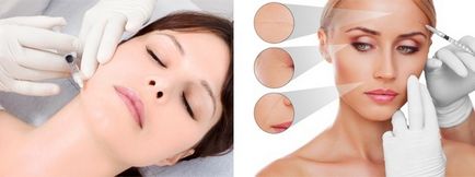 Біоревіталізація - новітній метод омолодження шкіри