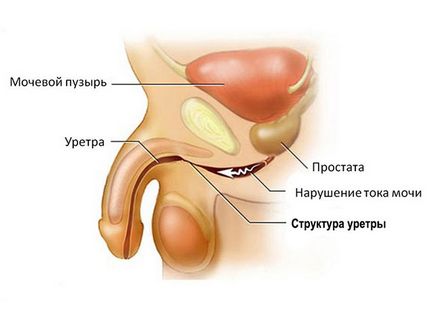 Біль в статевому члені причини і методи лікування