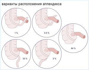 Какво става, ако болки в стомаха в ляво по време на бременност