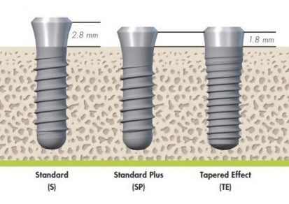 Az implantátumok Straumann fogak (fejlesztési Svájc) (implantátum Straumann) Az implantátumok Straumann fogak (fejlesztési Svájc)