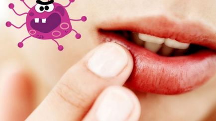 Cum să scap de rezolvarea problemelor de herpes