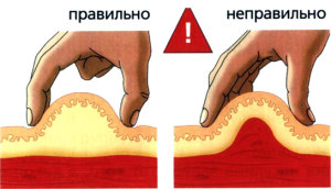 Як колоти інсулін