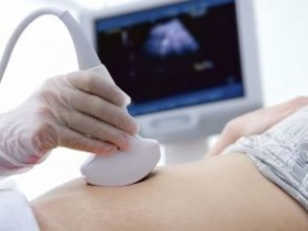 Cum să vă protejați de vergeturi în timpul sarcinii, prima sarcină