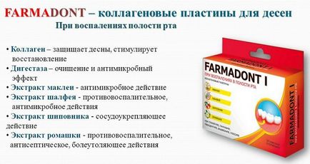 Колагенові пластини для ясен фармадонт (farmadont) склад, інструкція, відгуки
