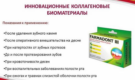 Колагенові пластини для ясен фармадонт (farmadont) склад, інструкція, відгуки