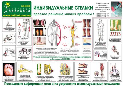 Cine și de ce insole individuale ortopedice au nevoie de Institutul de Sănătate