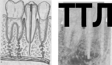 Structurile de implant