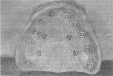 Structurile de implant