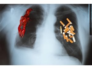 Куріння і туберкульоз • куріння при туберкульозі
