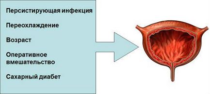 Лікування циститу у жінок як швидко лікувати хворобу, якими ліками