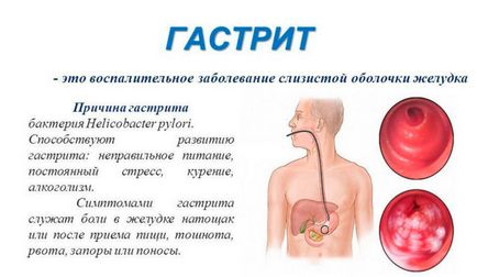 Мед для лікування при захворюваннях шлунково-кишкового тракту