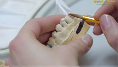 Medilayn-TV videó a fogászat és fogászati ​​szolgáltatásokat medilayn