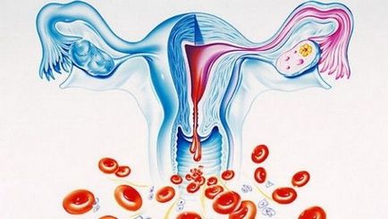 Lunar după chisturile laparoscopice ale ovarelor și trompelor uterine