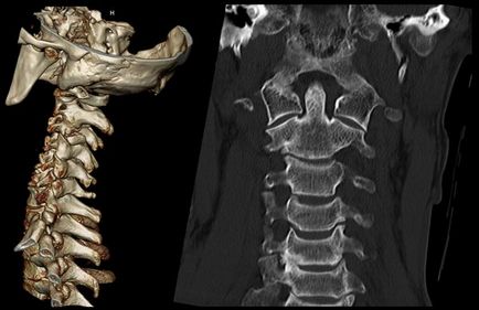 Metode de diagnosticare a kt sau mrt care este diferența și ceea ce este mai bine