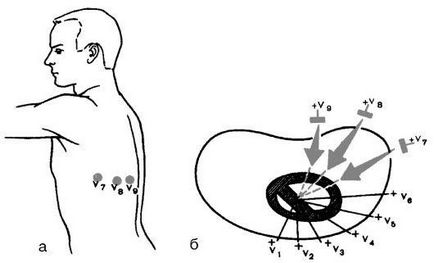 Metodă de înregistrare a electrocardiogramei