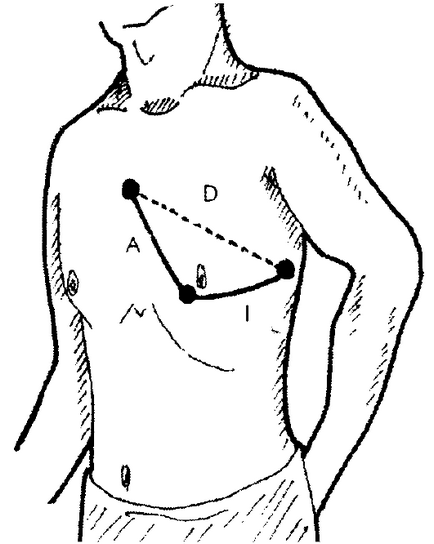 Metodă de înregistrare a electrocardiogramei