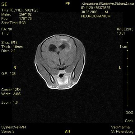 nekrotizáló encephalitis