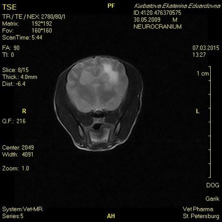 nekrotizáló encephalitis