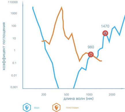 Ооо «Юрикон-група» - продаж медичних лазерних апаратів, інноваційний лазерний апарат act