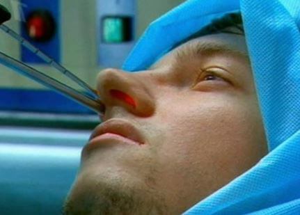 Операція на ніс ринопластика, видалення кіст і поліпів