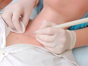Papillóma kezelés a láb (Van is használható) Papilloma a lábát kezelés