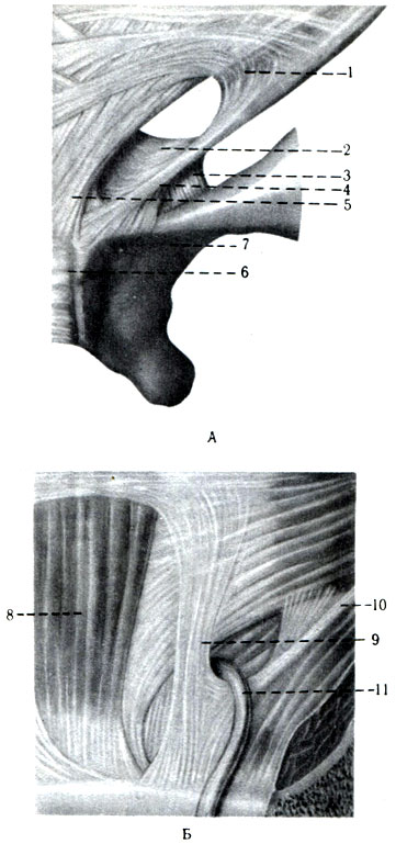 Canalul inghinal 1978 marginea a